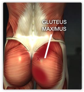 gluteusmax.jpg